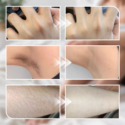 Kaufen Sie 2 und erhalten Sie 1 gratis 🎁Sanfte Enthaarungscreme für Männer und Frauen