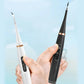 🦷🔥Bargain Alert ￡9.99!!⚡Electric Ultrasonic Dental Scaler | Remove Tartar & Plaque✨
