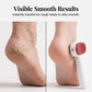 Double-Sided Foot Scraper For Callus Removal - 🎁 With Free Replacement Head